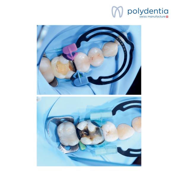 myTines Small & Medium & Large – Image 2