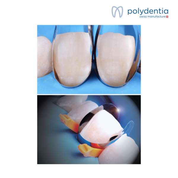 Unica anterior matrix – Image 3