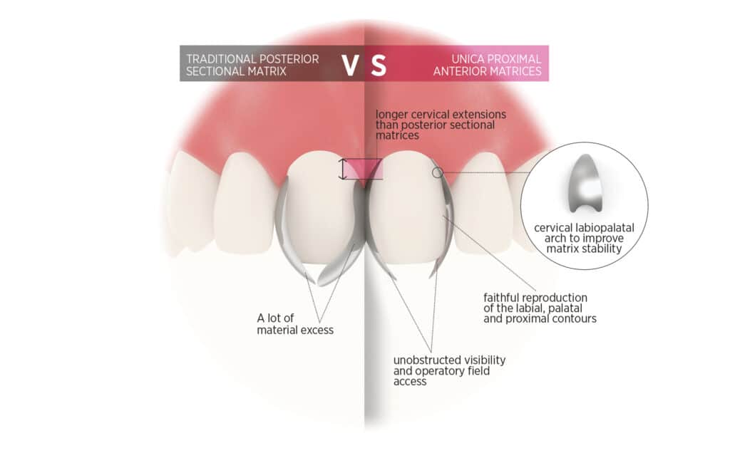 Unica Proximal anterior matrices – Image 3
